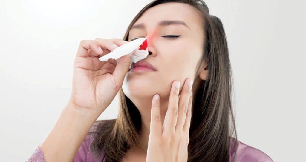 اتبعها .. طرائق لعلاج رعاف الأنف