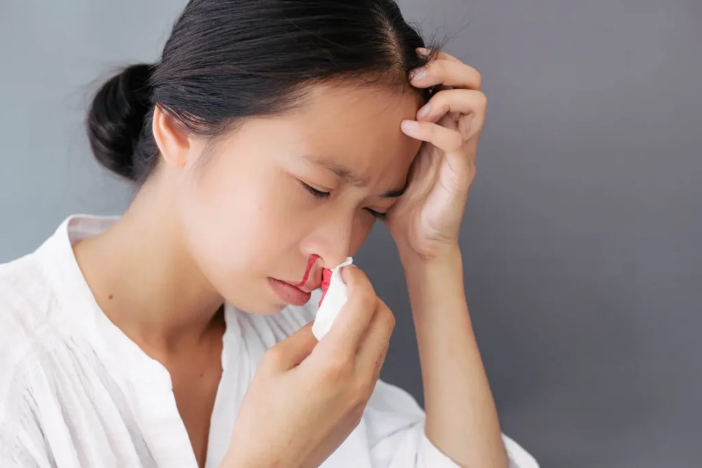 كل ما تود معرفته عن أسباب الرعاف "نزيف الأنف"