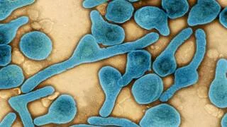 تفشّي فيروس ماربورغ في رواندا: 8 وفيات وإجراءات احترازية مشددة