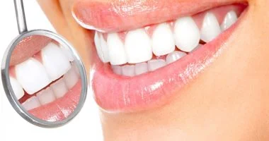 التهاب اللثة في سن المراهقة: تهديد صامت لابتسامتك